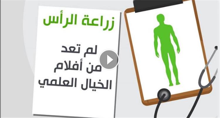 زراعة الرأس ... لم تعد من أفلام الخيال العلمي !